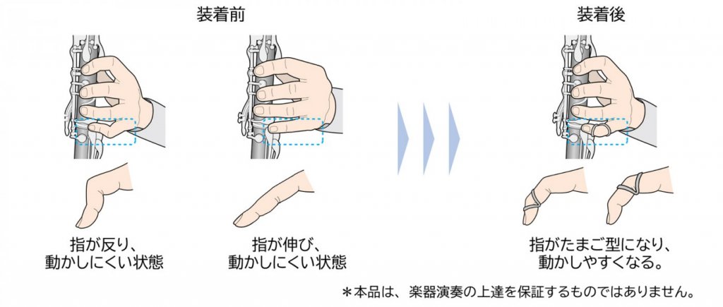 Ovaring(オーバリング) 画像 3