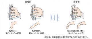 Ovaring(オーバリング) 画像 3